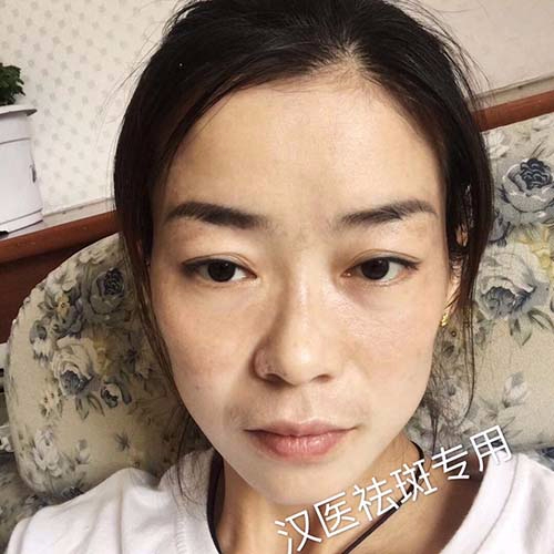 純中藥?kù)畎叽砑用苏猩? title=